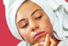 Everything You Need to Know About Dermatillomania