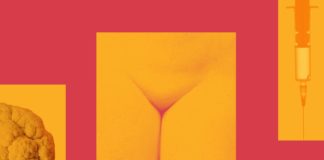 Everything You Need to Know About Genital Warts