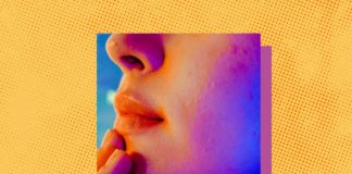 Can Pantothenic Acid Help Fight Acne?