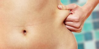 What to Do About the Loose Skin After Successful Weight Loss