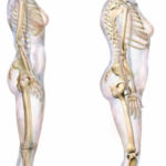 hyper-kyphosis-thoracic-spine.jpg